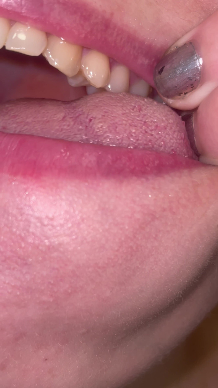 Glitterqueen1999: Mouth Tour No Makeup Teeth Tongue Uvula Tonsils Check