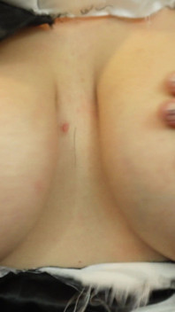 7134944