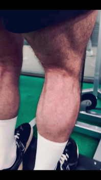 My Legs