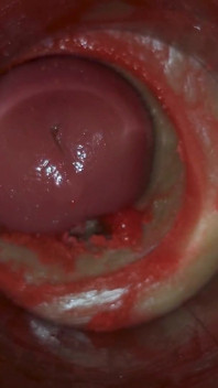 Camera dentro la figa profonda cattura un enorme eiaculazione di sperma ASMR