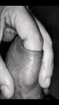 Foreskin Play