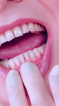 Latex Gloves Asmr Video. Dentist Fetish. Arya Grander