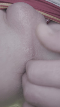 It Hurts, but I Still Need It