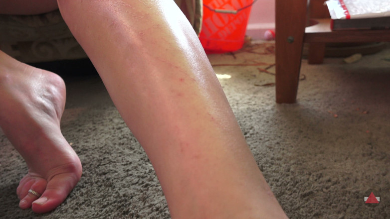 Grand D assjob: Sunny's Sexy Scars