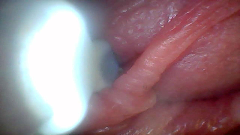 Twittiy: Kamera Endoscope Menunjukkan Bahagian Paling Sensitif Video Pendidikan Zakar