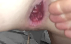 21 yaşındaki fahişemin göt deliğine yumruk sokmuşken tekrar tekrar fışkırtıyorum