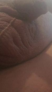 Penis