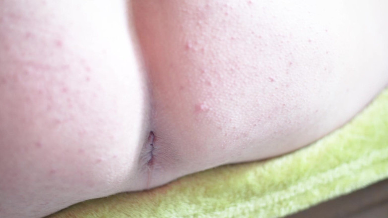 Marcus Pollack Gay: 멍청이 클로즈업