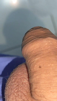 Mysterious Solution Inserted Into the Wrinkled Cock.