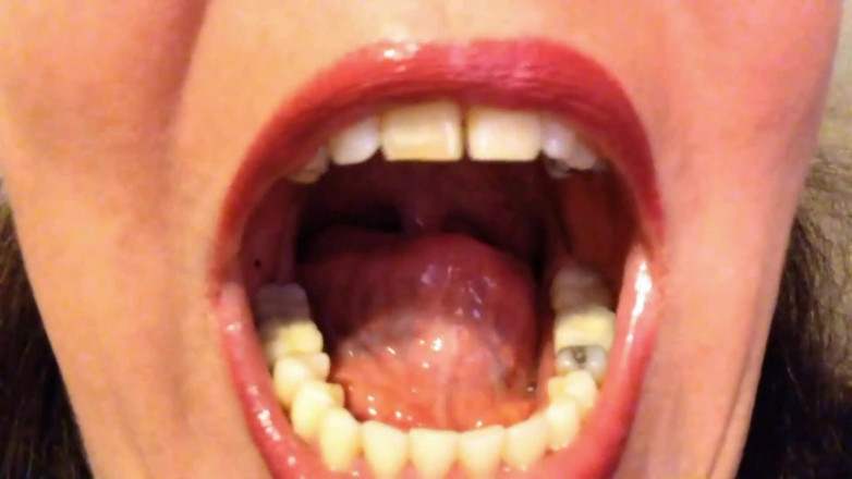 Lily Lipstixxx: Mouth inspection - Be careful, I bite!