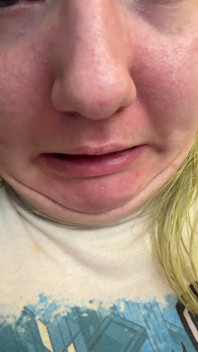 Chin Faces