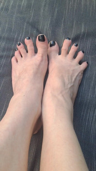 Do We See How Beguiled My Throbbing Foot Veins Are