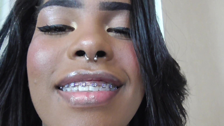 Solo Austria: Black girl teeth brace fetish!