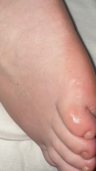 Pancutan mani pada kaki malam