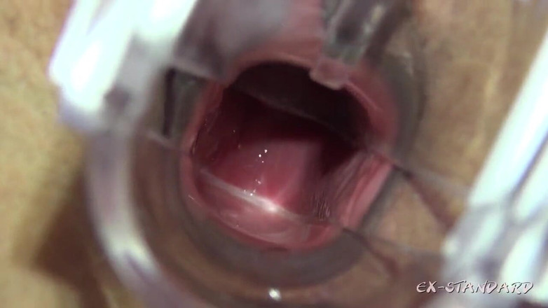 Sky Angel: Ángel asiático 18730