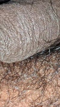 Hairy Panes