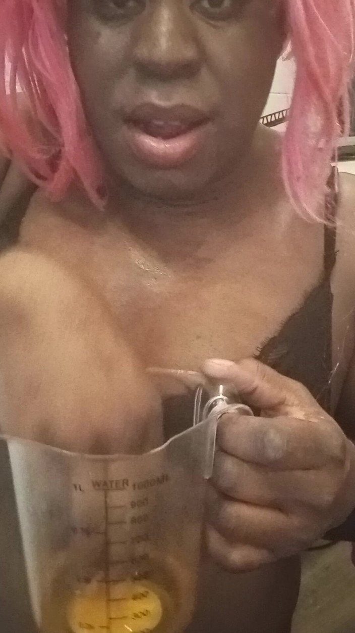 Anoniema Rose: Dutch Orange Salty Pissdrinkig