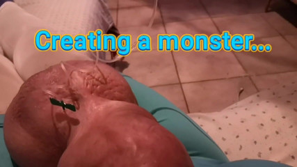 Monster_Meat_: Llenar con glucosa 10%
