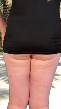 Anal BDSM