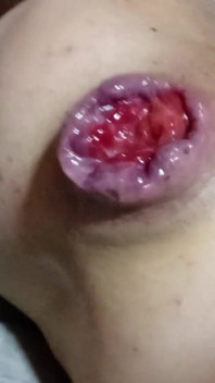 Anal Orgasm