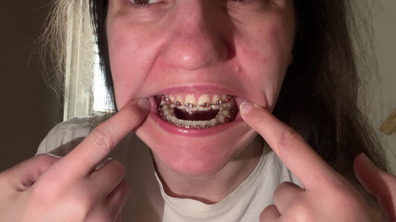 NicoleRay: Lingând aparatul dentar cu limba