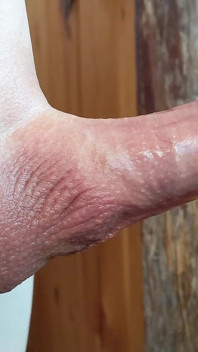 Small Hairless Virgin Phimosis Dick Braves the Cold for Some Hands-free Edging and Leaking Cum