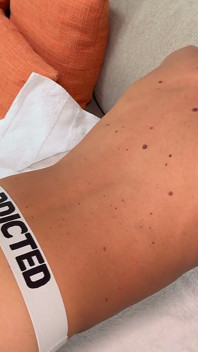 Louis Fode O Cu De Um Twink