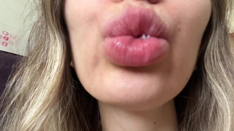 Rarible Diamond: 자이언트 즈