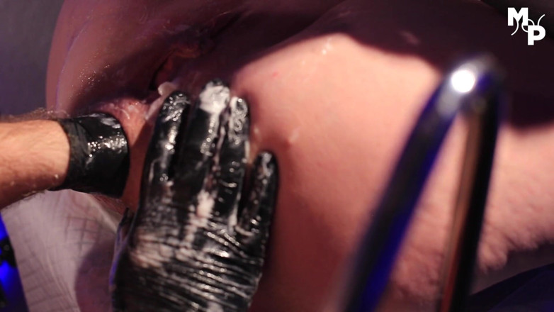 Marcus Pollack: Brush out her holes