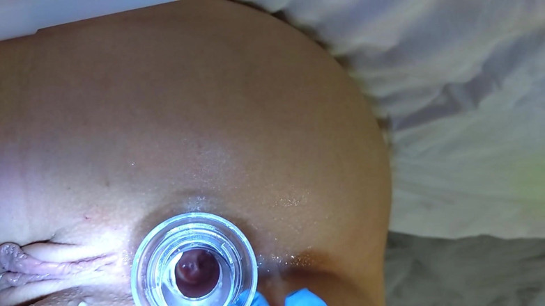 BABYGIRL 18YO: Video medizinisch komplett 2