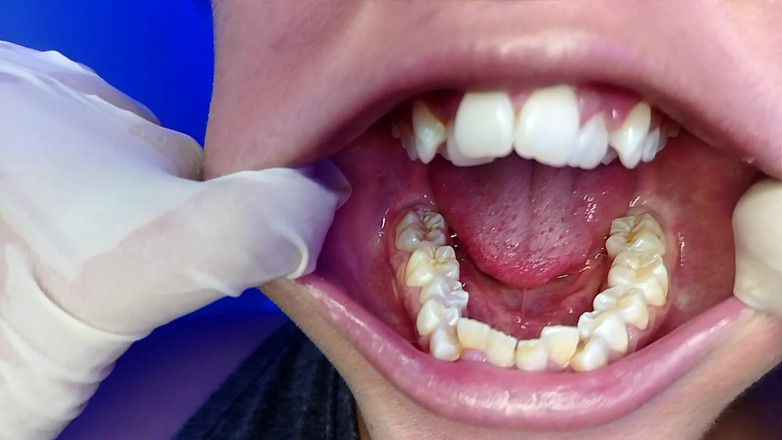 Elimoon: Чищу зуби і показую тобі мої зуби (крупним планом)