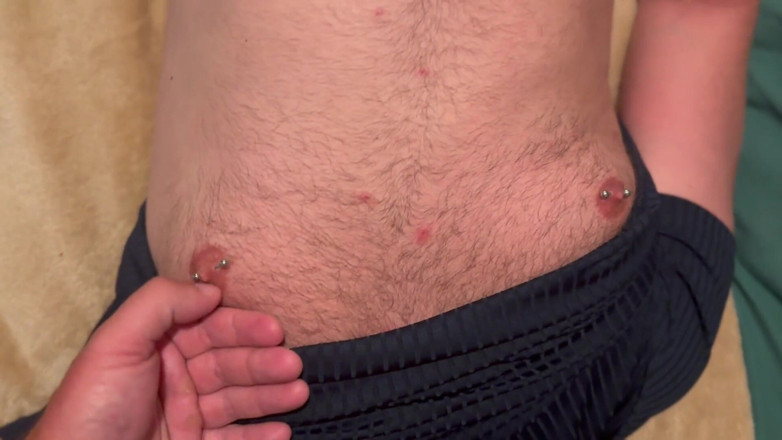 Glenn and Sonny: Hot Facial