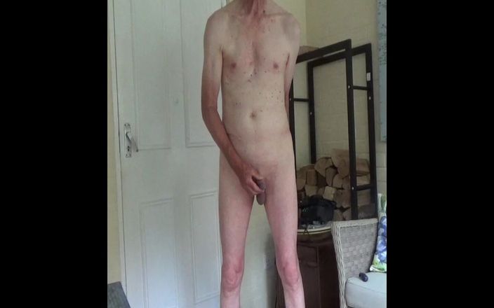 bigears: Prostata