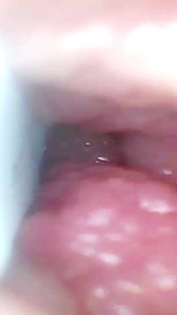 Kamera Endoskopi Merekam G Spot Istriku. Video edukatif close up