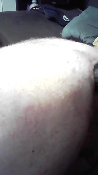 Anal-sesion