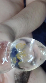 My Anal