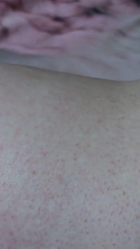 SSBBW up Close Body Exploration Stretch Marks