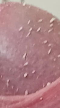 Smegma Foreskin Roll. bigpisser