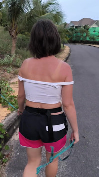 She Really Likes to Sunburn