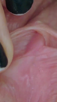 Clitóris e Vagina