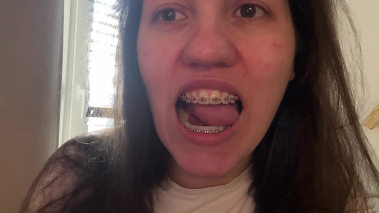 NicoleRay: Liếm niềng răng bằng lưỡi