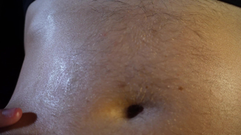 Navel fans: Alexs diepe navel: uitgezogen, uitgeduwd en strak vastgebonden