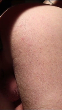 Cetriolo anale