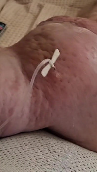 Extreme Fillings Inside My Siliconemeat