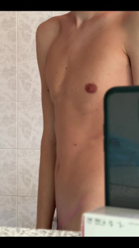 My body