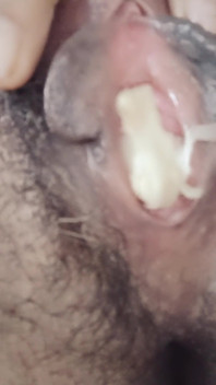 毛