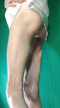 黄色格纹丁字裤和缎面白色睡衣