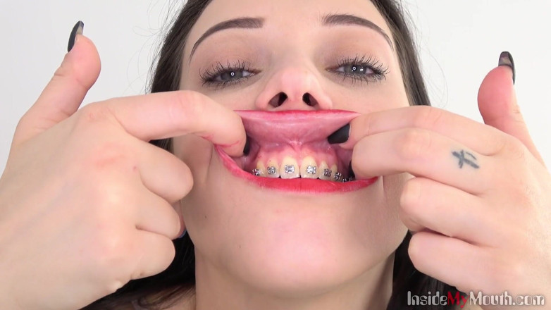 Inside My Mouth: Video fetish della bocca con Bara che mostra l'apparecchio dentale.