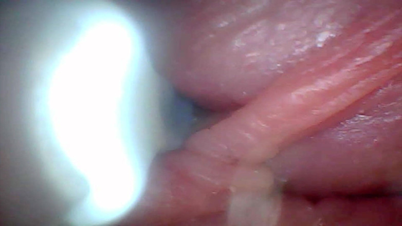 Twittiy: Endoskop kamera penis eğitim videosunda en hassas kısımlarını gösteriyor