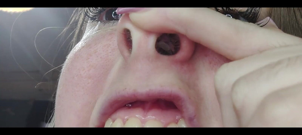 RavenHearth666VIP: 콧물 코 클로즈업